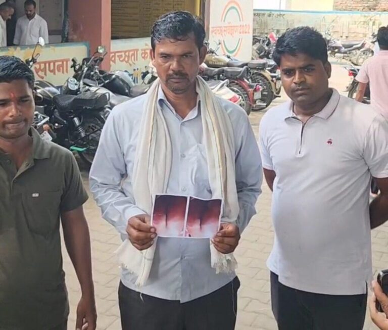 संभल-पुलिस पर अवैध हिरासत मे रख ग्राम प्रधान ने लगाया पटे से पिटाई करने का आरोप